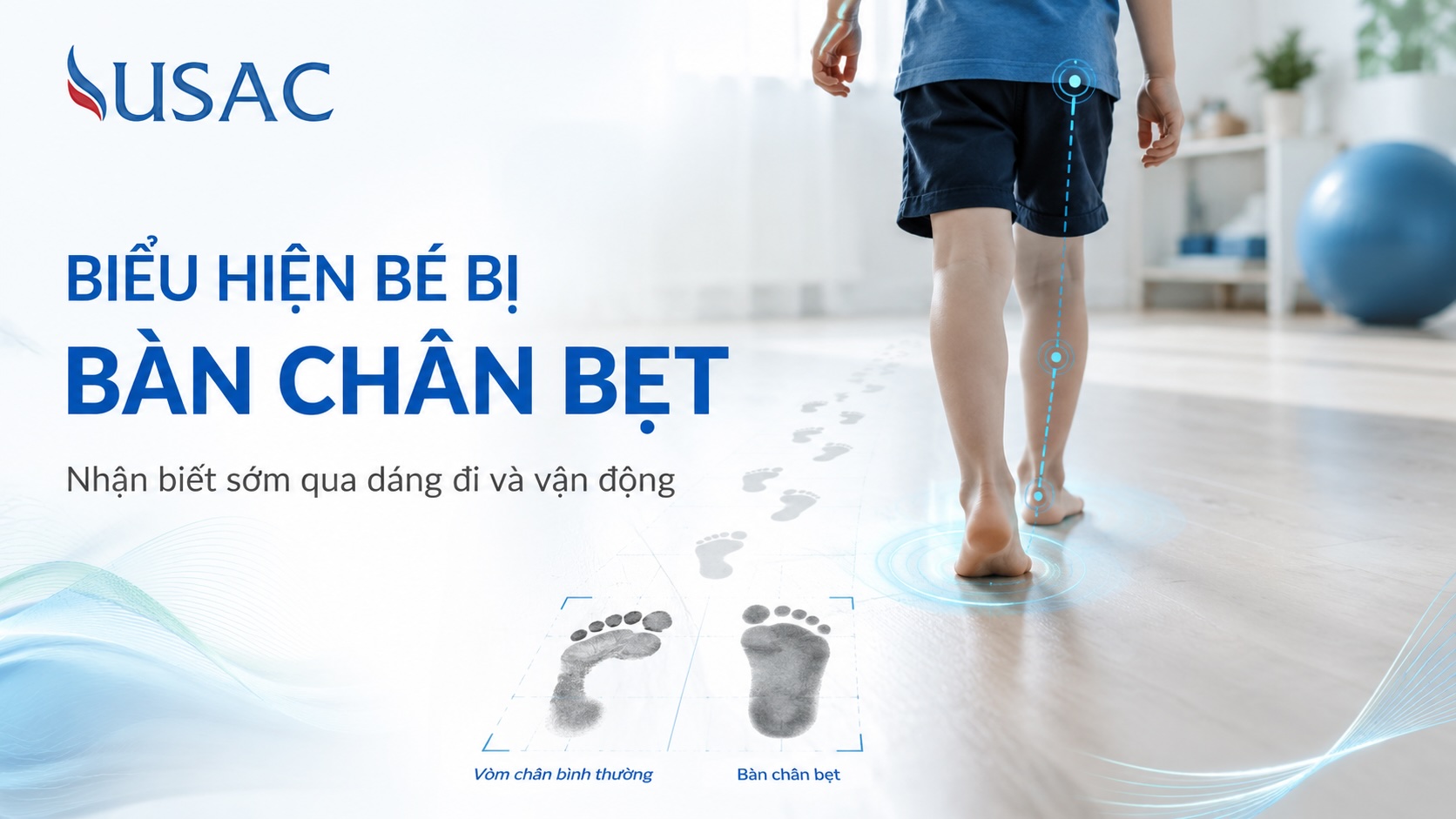 Biểu Hiện Bé Bị Bàn Chân Bẹt Biểu Hiện Bé Bị Bàn Chân Bẹt