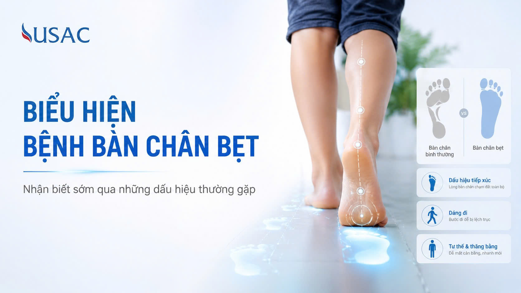 Biểu Hiện Bệnh Bàn Chân Bẹt Biểu Hiện Bệnh Bàn Chân Bẹt