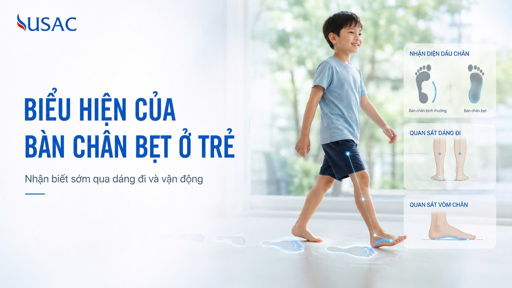 Biểu Hiện Của Bàn Chân Bẹt Ở Trẻ