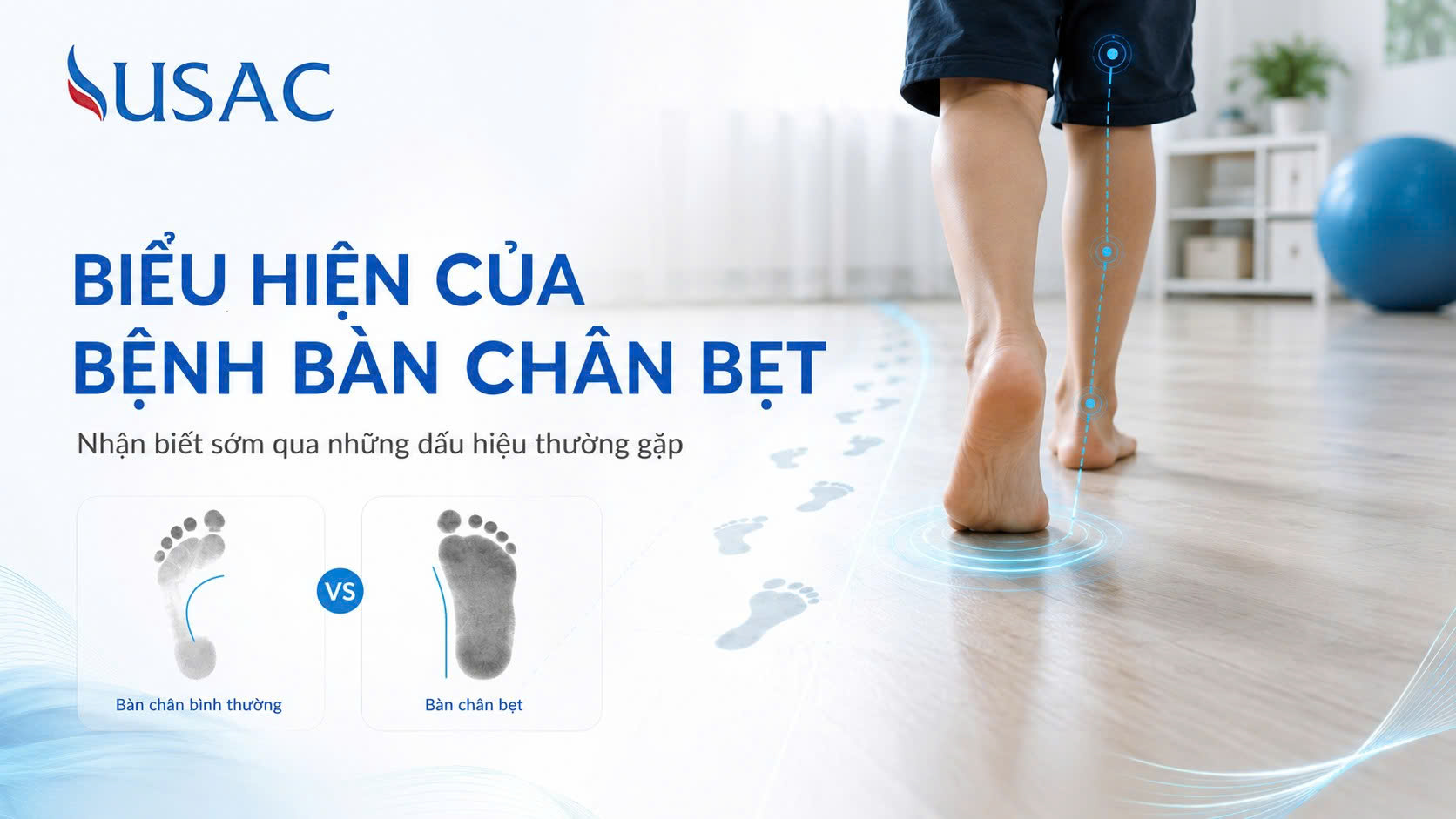 Biểu Hiện Của Bệnh Bàn Chân Bẹt