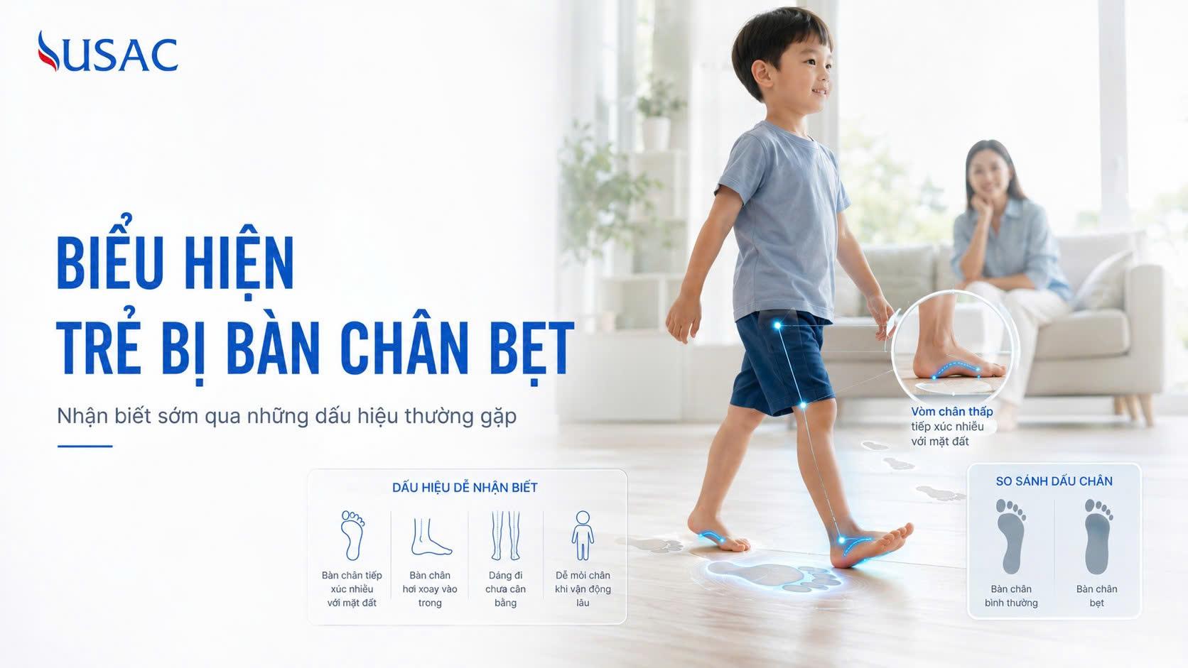 Biểu Hiện Trẻ Bị Bàn Chân Bẹt Biểu Hiện Trẻ Bị Bàn Chân Bẹt