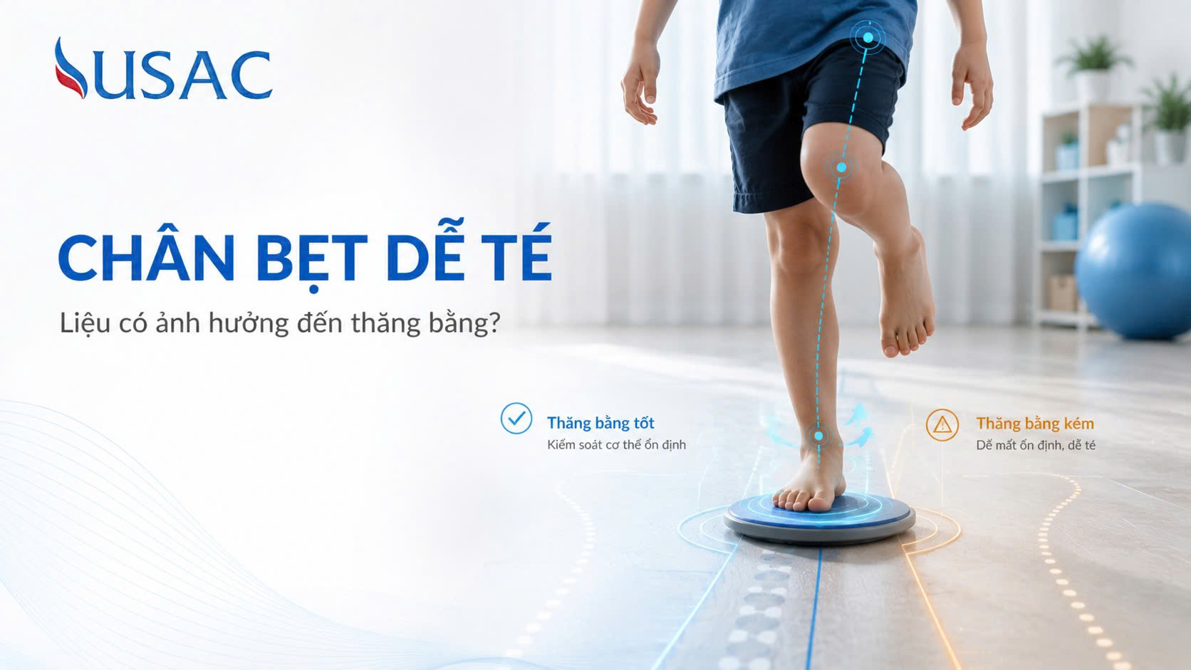 Chân Bẹt Dễ Té