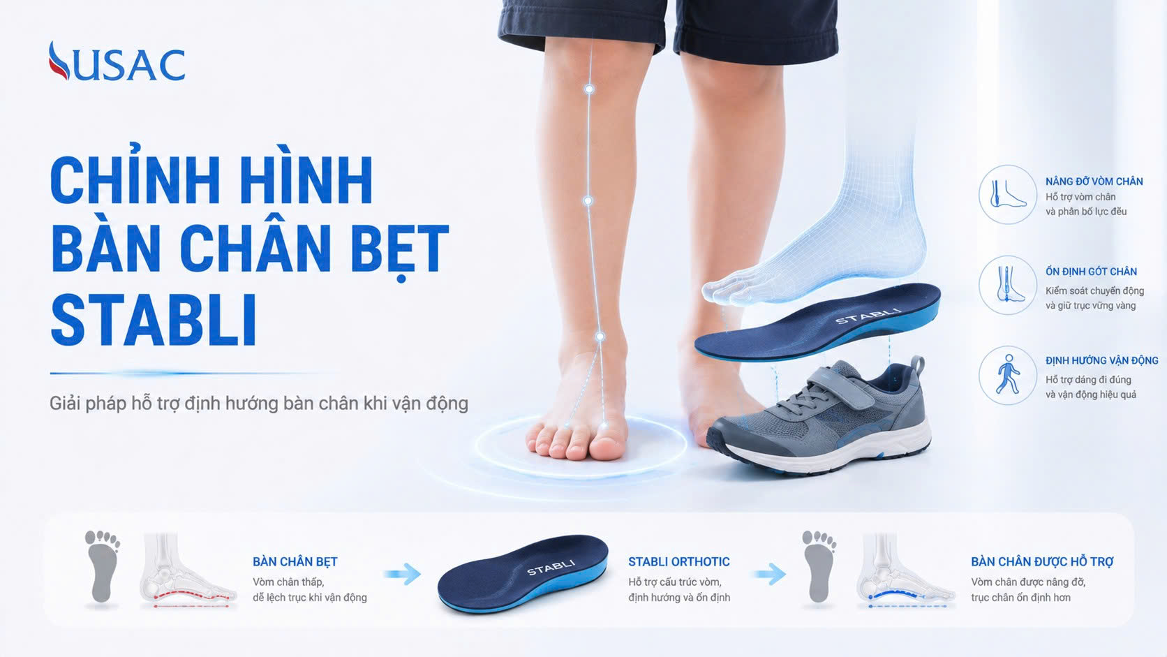 Chỉnh Hình Bàn Chân Bẹt Stabli Chỉnh Hình Bàn Chân Bẹt Stabli