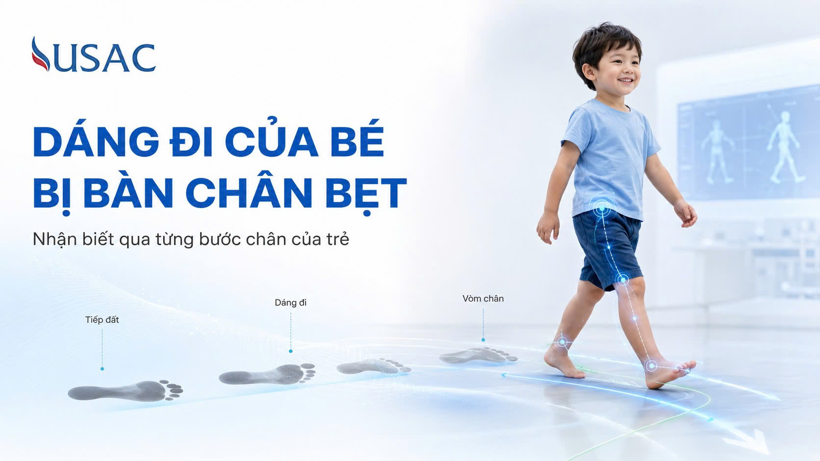 Dáng Đi Của Bé Bị Bàn Chân Bẹt Dáng Đi Của Bé Bị Bàn Chân Bẹt