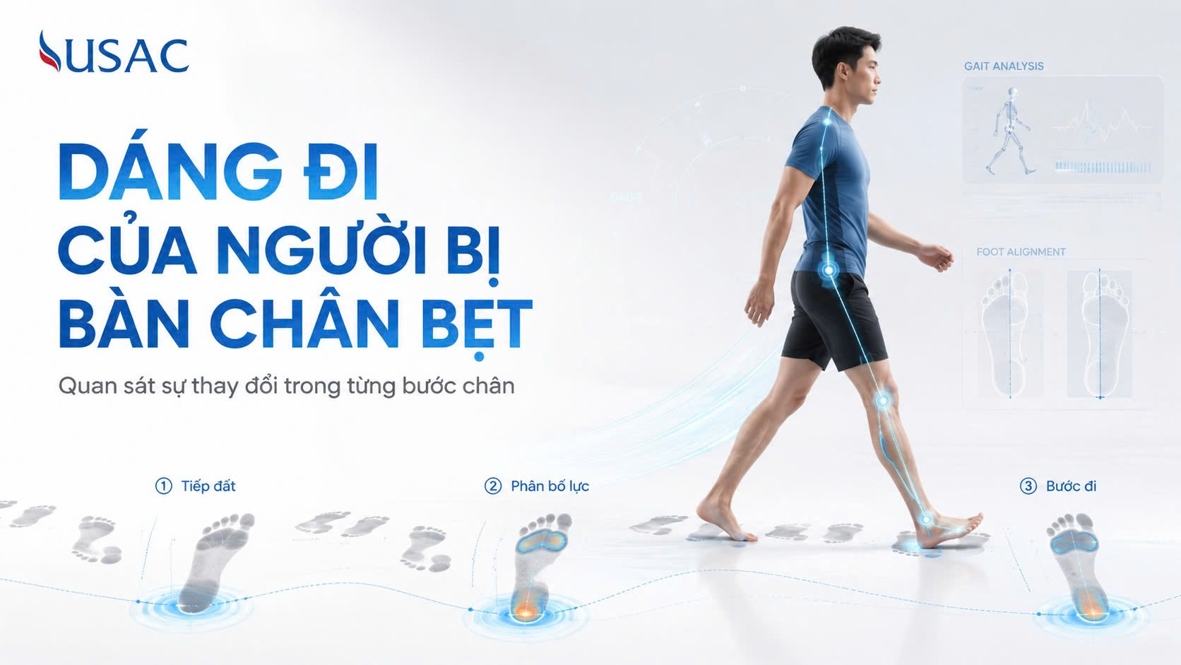 Dáng Đi Của Người Bị Bàn Chân Bẹt Dáng Đi Của Người Bị Bàn Chân Bẹt