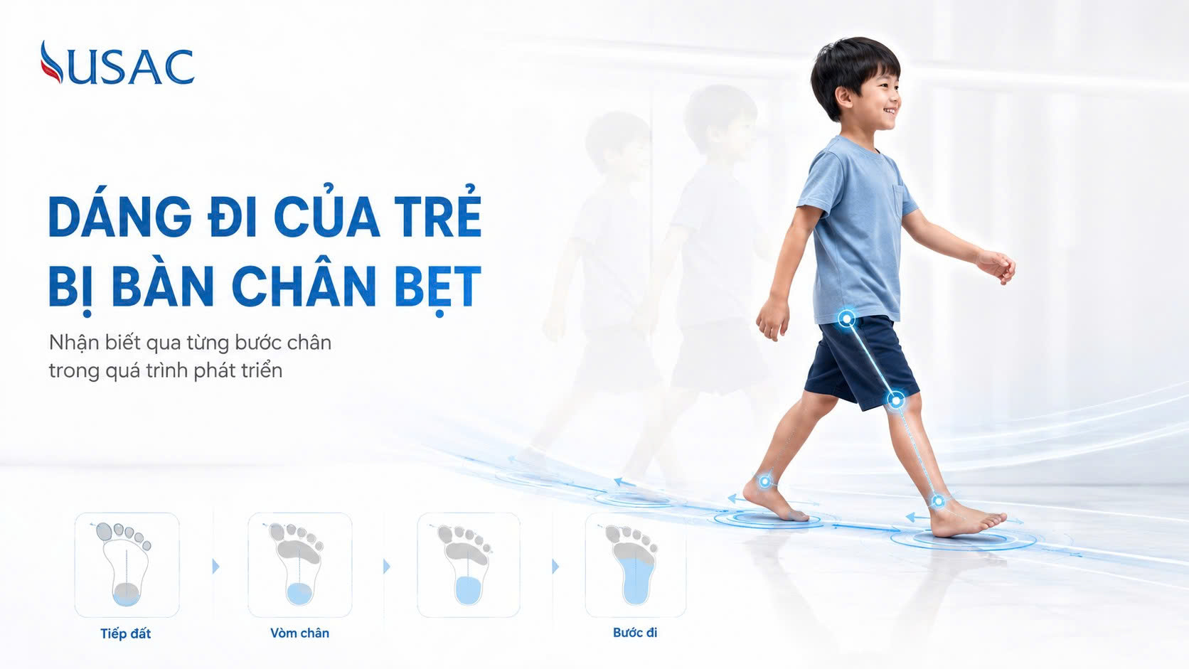 Dáng Đi Của Trẻ Bị Bàn Chân Bẹt Dáng Đi Của Trẻ Bị Bàn Chân Bẹt