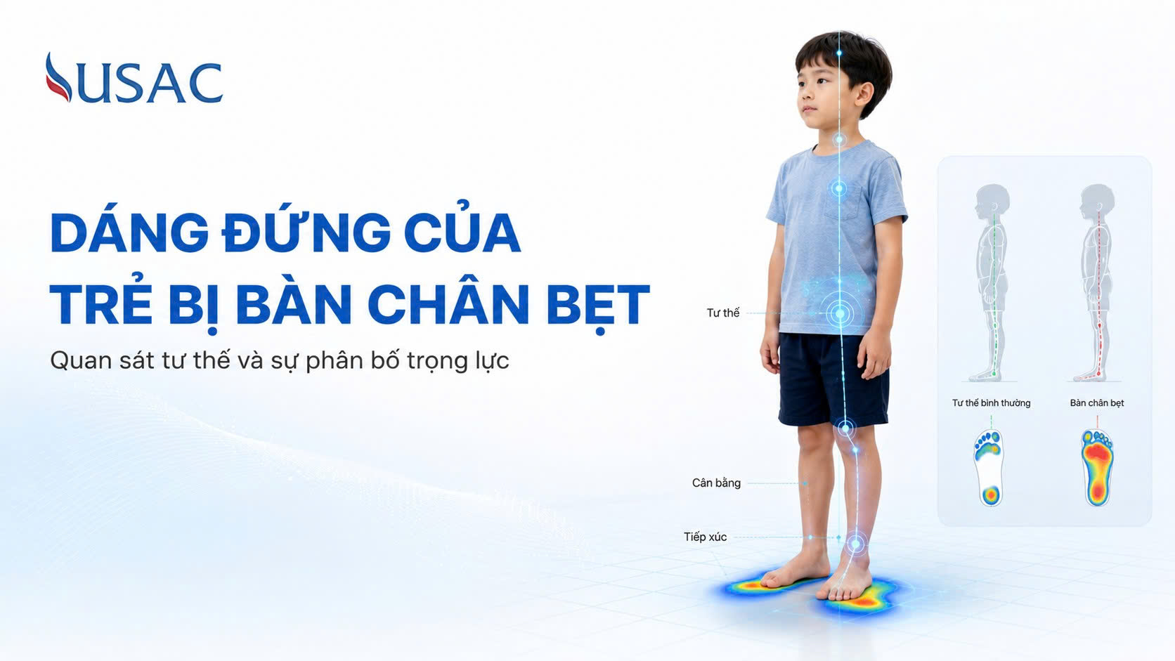 Dáng Đứng Của Trẻ Bị Bàn Chân Bẹt Dáng Đứng Của Trẻ Bị Bàn Chân Bẹt