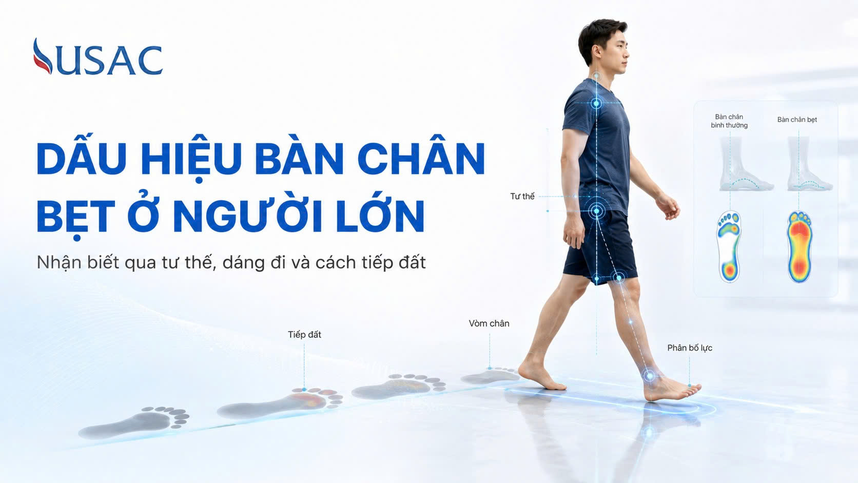 Dấu Hiệu Bàn Chân Bẹt Ở Người Lớn