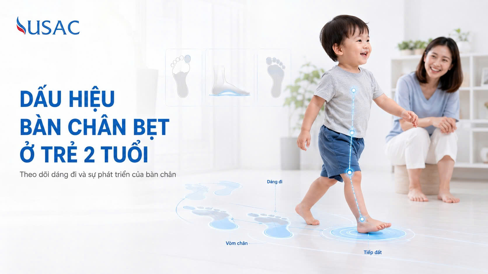 Dấu Hiệu Bàn Chân Bẹt Ở Trẻ 2 Tuổi
