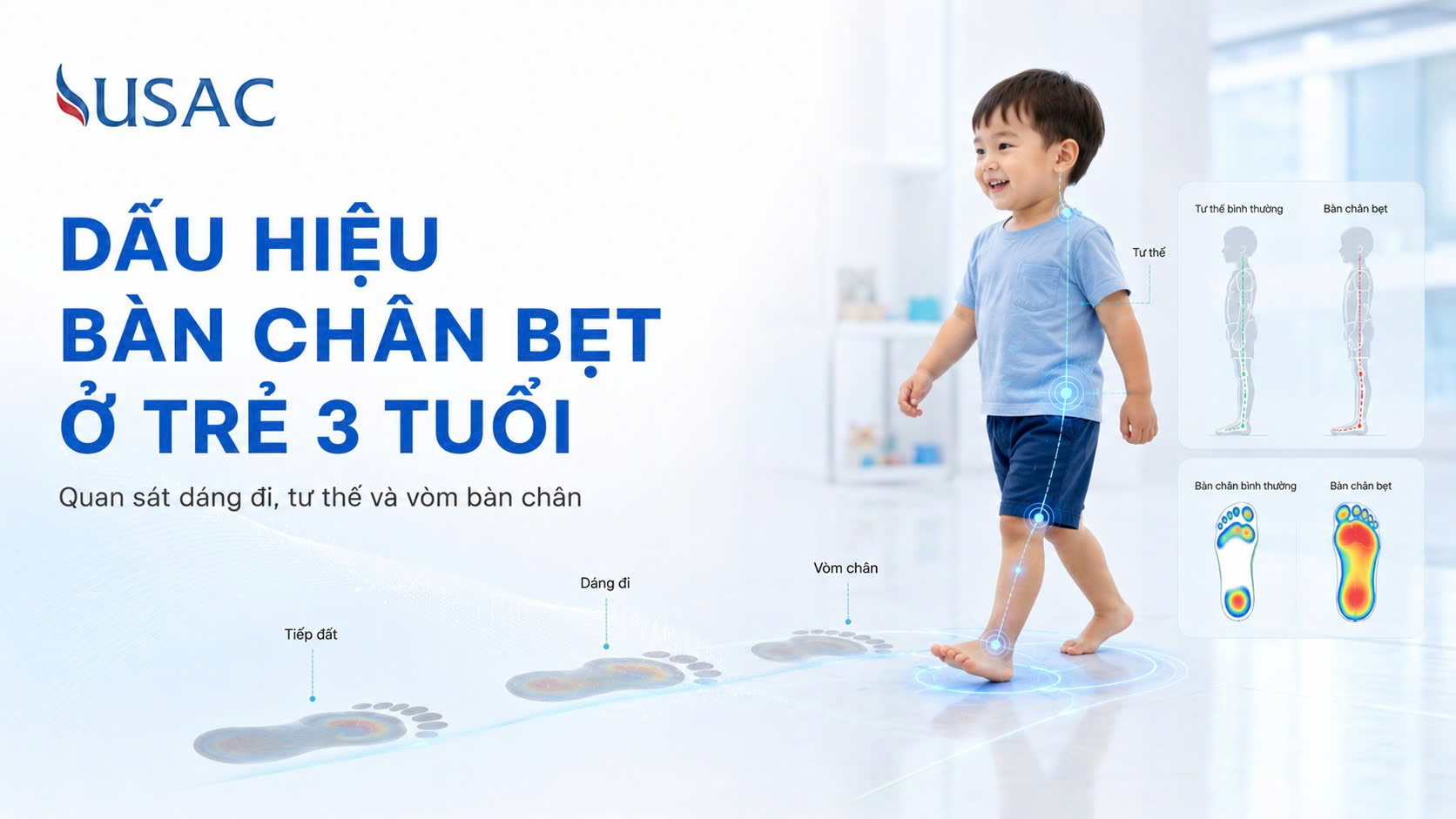 Dấu Hiệu Bàn Chân Bẹt Ở Trẻ 3 Tuổi