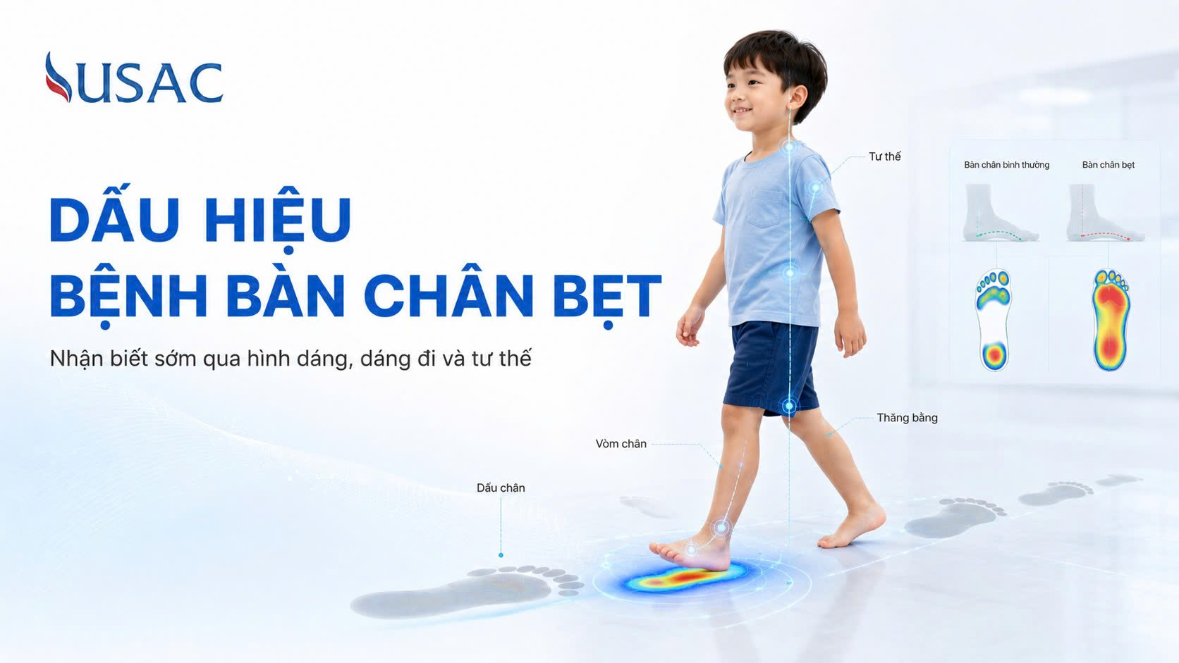 Dấu Hiệu Bệnh Bàn Chân Bẹt Dấu Hiệu Bệnh Bàn Chân Bẹt