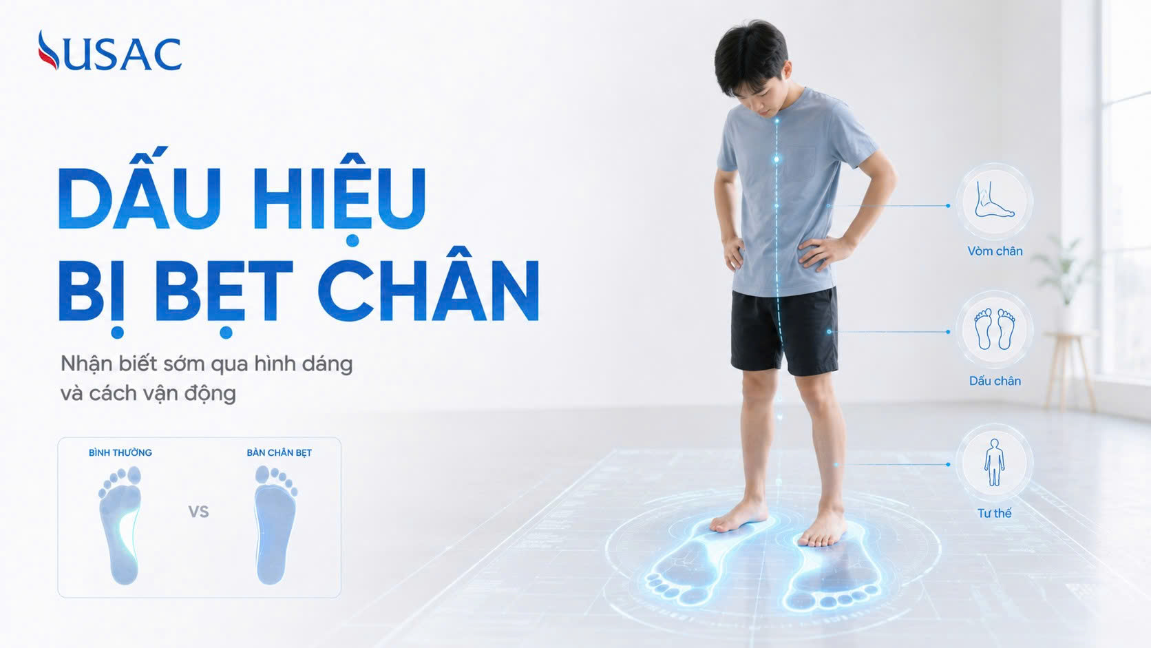 Dấu Hiệu Bị Bẹt Chân