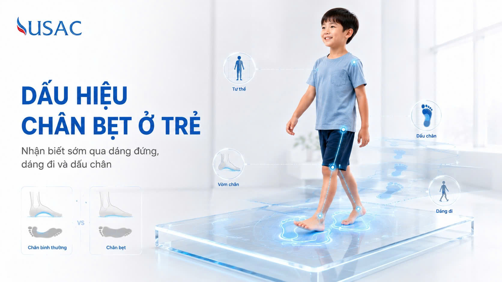 Dấu Hiệu Chân Bẹt Ở Trẻ Dấu Hiệu Chân Bẹt Ở Trẻ