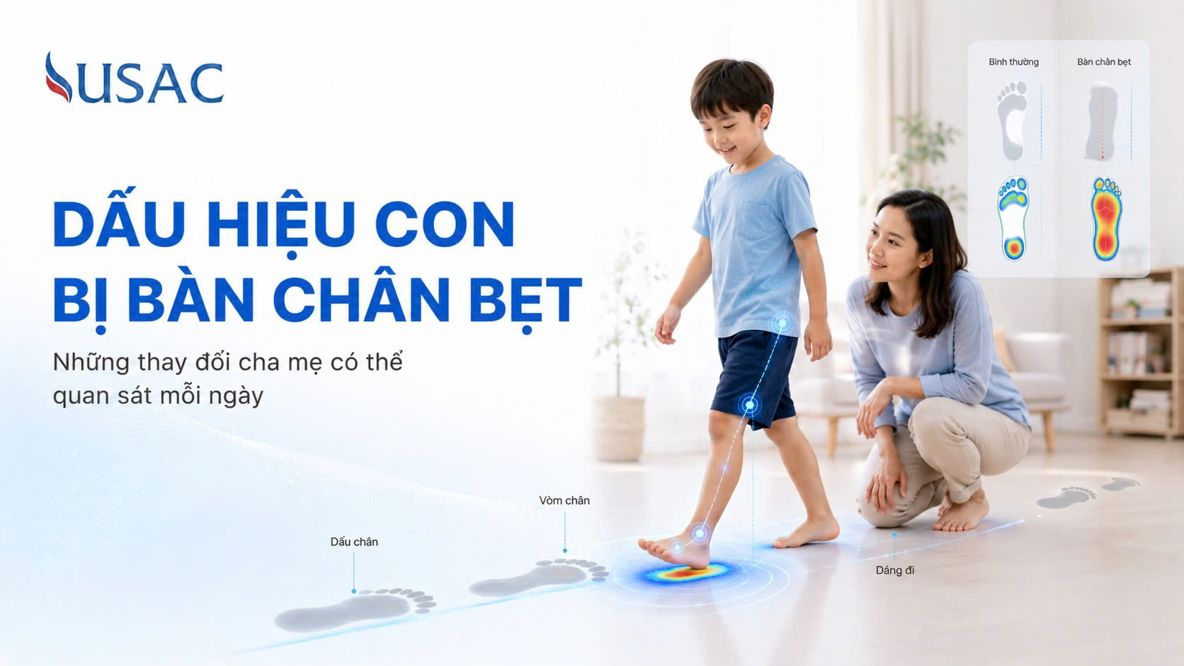Dấu Hiệu Con Bị Bàn Chân Bẹt Dấu Hiệu Con Bị Bàn Chân Bẹt