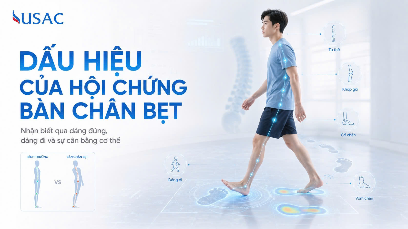 Dấu Hiệu Của Hội Chứng Bàn Chân Bẹt Dấu Hiệu Của Hội Chứng Bàn Chân Bẹt