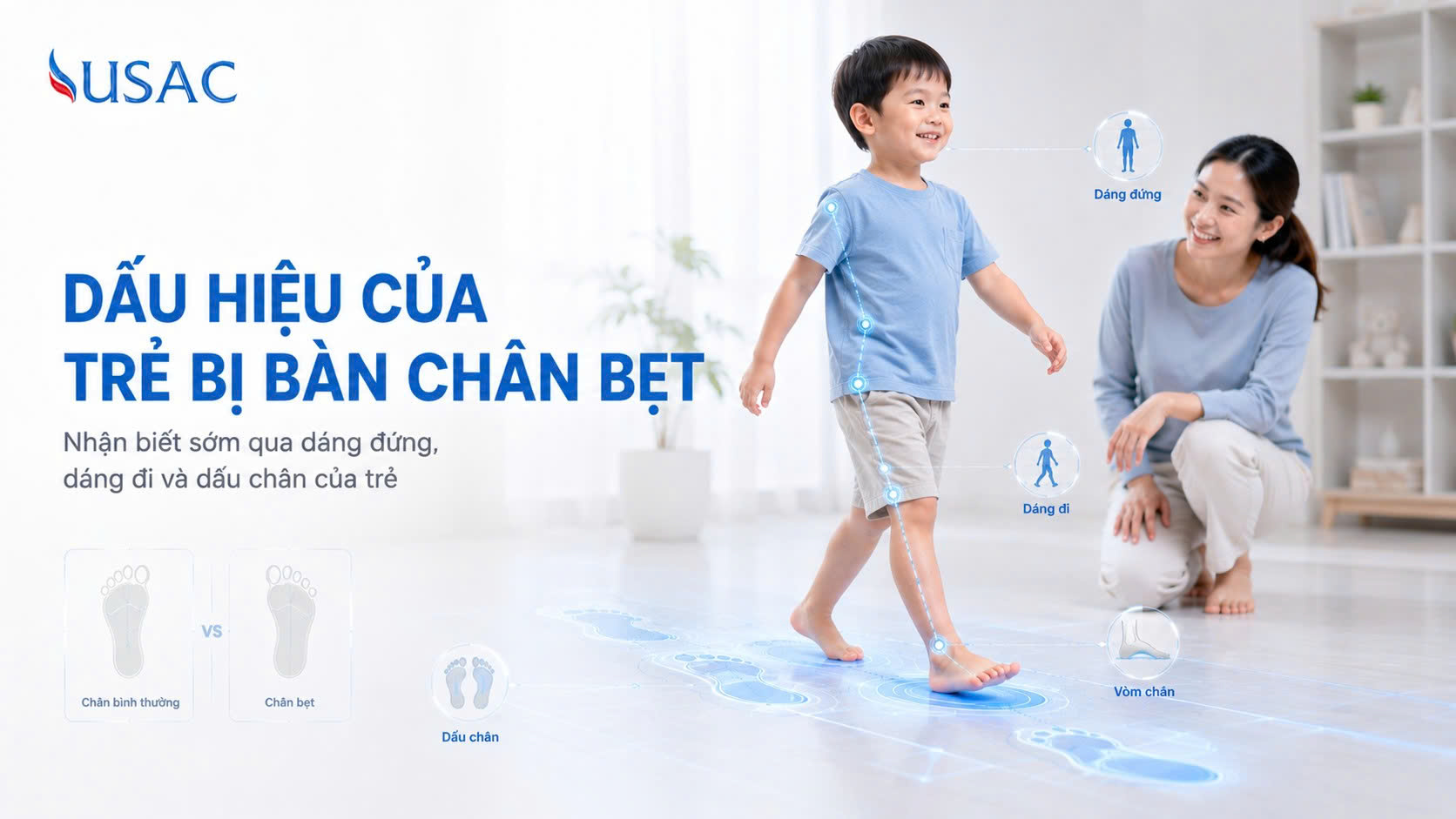 Dấu Hiệu Của Trẻ Bị Bàn Chân Bẹt Dấu Hiệu Của Trẻ Bị Bàn Chân Bẹt