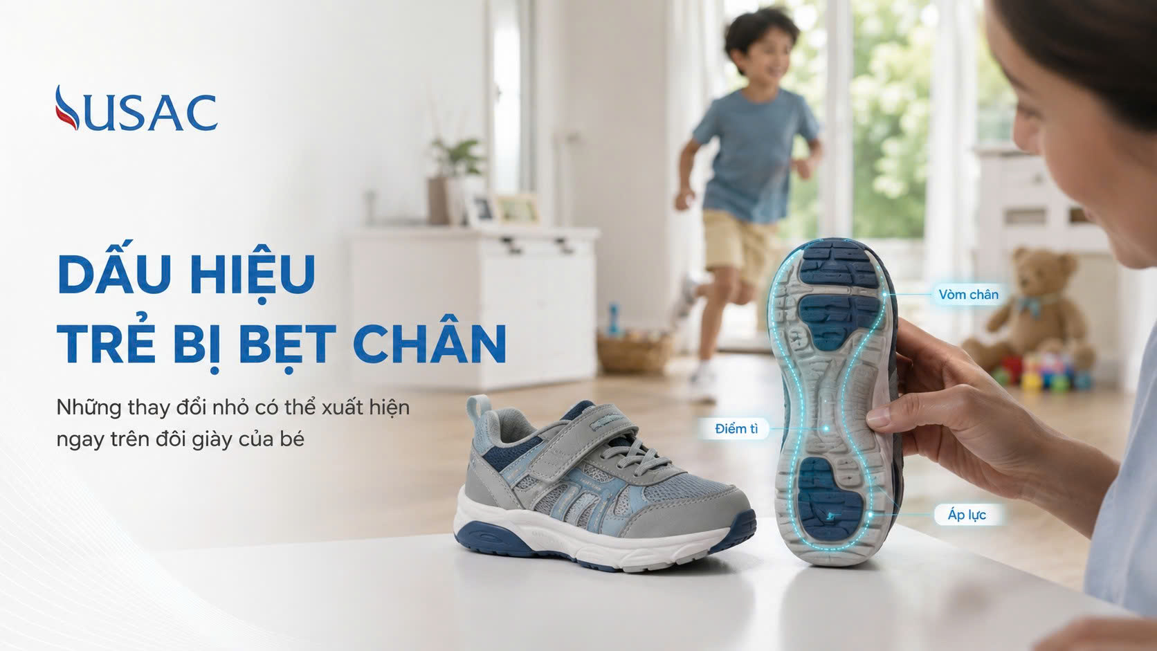 Dấu Hiệu Trẻ Bị Bẹt Chân Dấu Hiệu Trẻ Bị Bẹt Chân