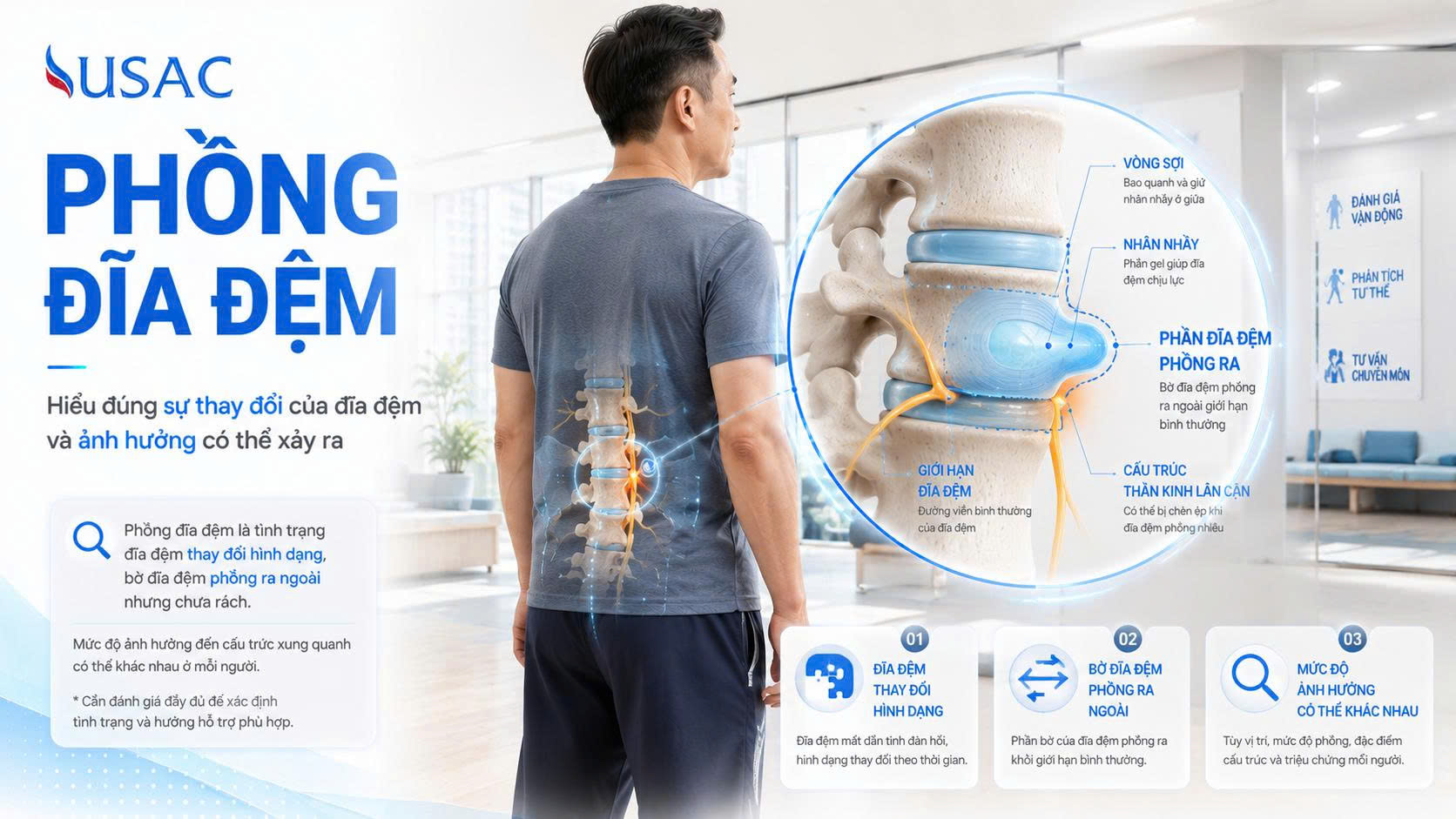 Phồng Đĩa Đệm Phồng Đĩa Đệm