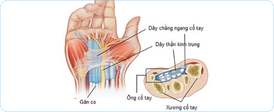 Treatment on the Wrist for Carpal Tunnel Syndrome: Quince Orchard Medical  Center: Integrative & Regenerative Medicine