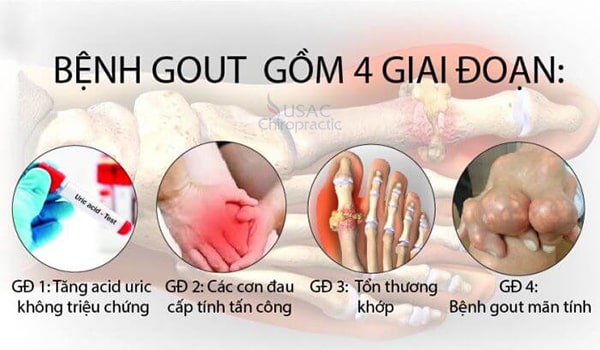các thực phẩm tốt cho người bệnh gout