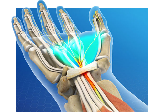 Treatment on the Wrist for Carpal Tunnel Syndrome: Quince Orchard Medical  Center: Integrative & Regenerative Medicine