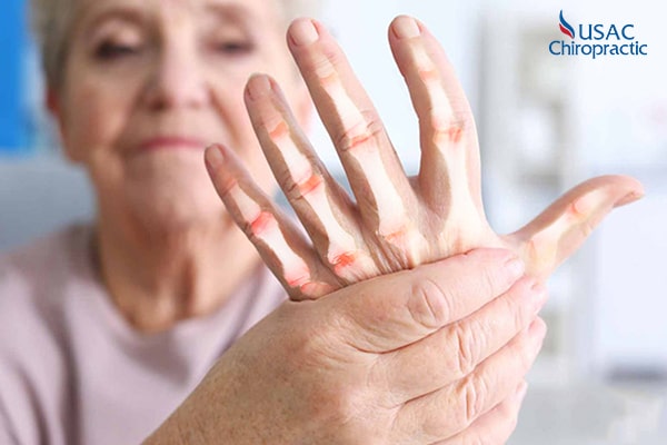 viêm khớp dạng thấp