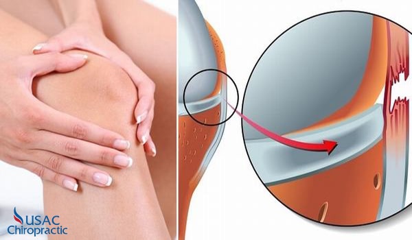 đứt dây chằng chéo trước bao lâu thì lành