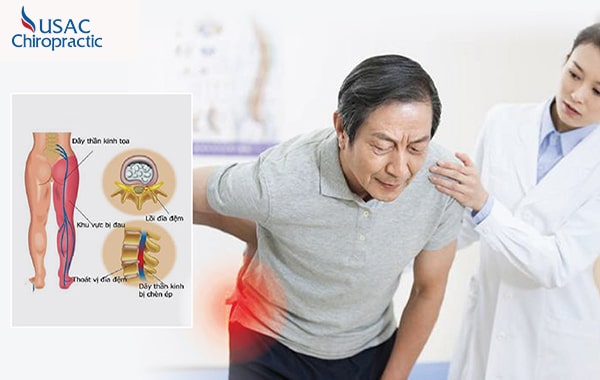 đau thần kinh tọa chữa bằng bài thuốc dân gian
