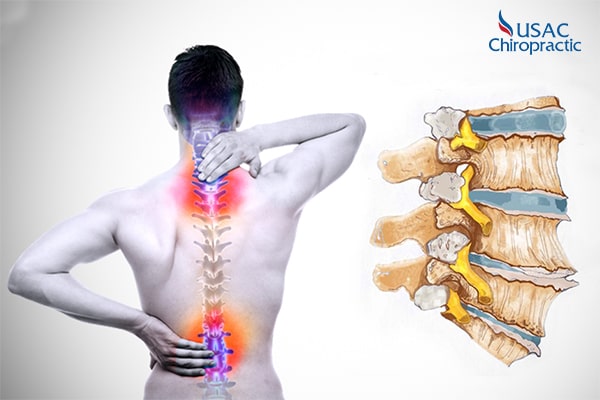nguyên nhân thoát vị đĩa đệm