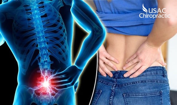 4 bài tập chữa đau lưng