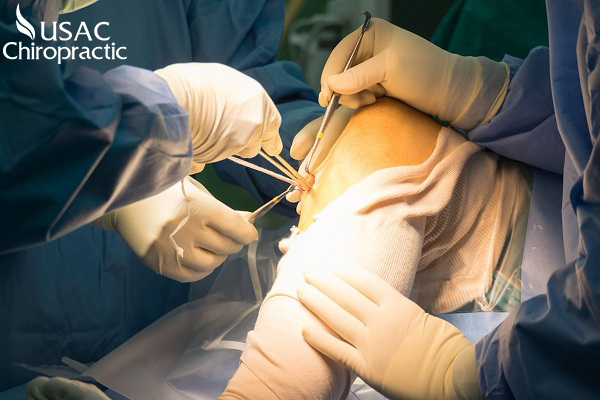 Phẫu thuật có thể là lựa chọn tốt nhất nếu bệnh nhân bị tổn thương dây chằng