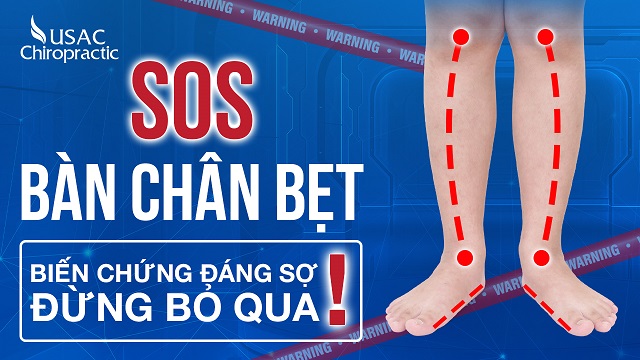 Địa chỉ khám và điều trị hội chứng bàn chân bẹt uy tín ở Hà Nội