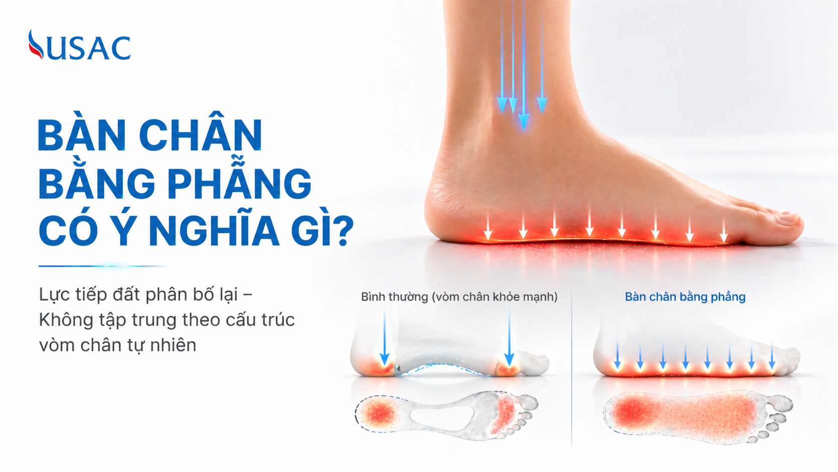 Bàn Chân Bằng Phẳng Có Ý Nghĩa Gì