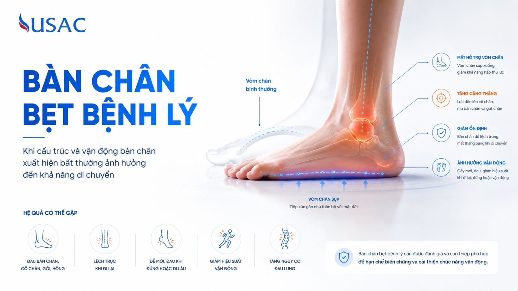 Bàn Chân Bẹt Bệnh Lý Bàn Chân Bẹt Bệnh Lý