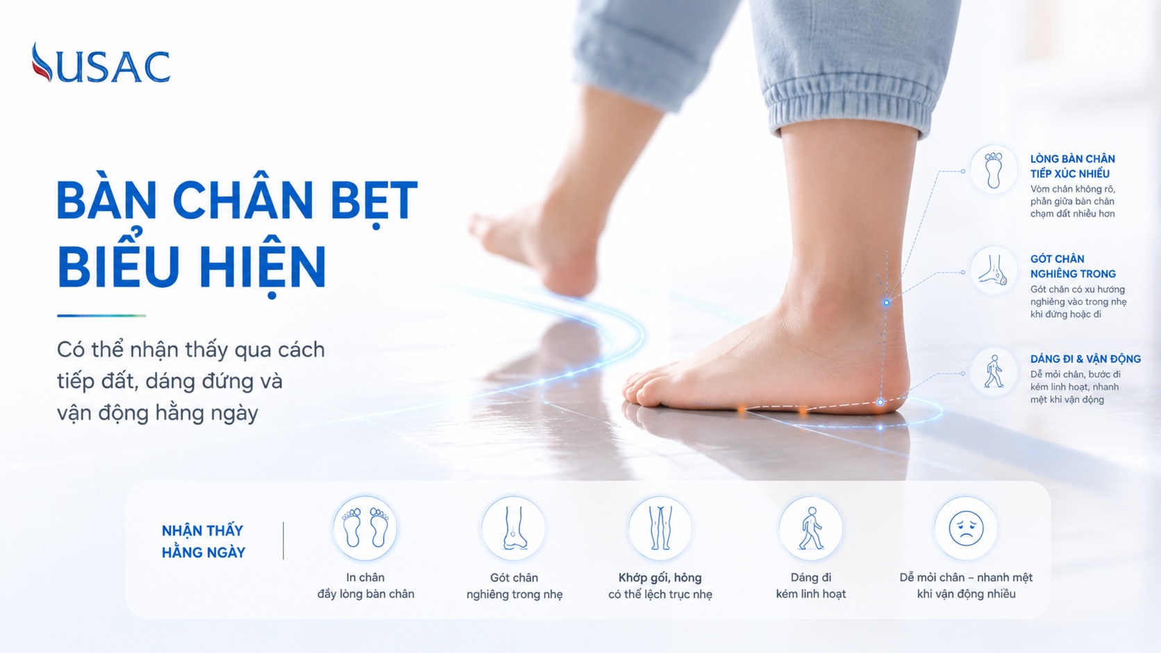 Bàn Chân Bẹt Biểu Hiện