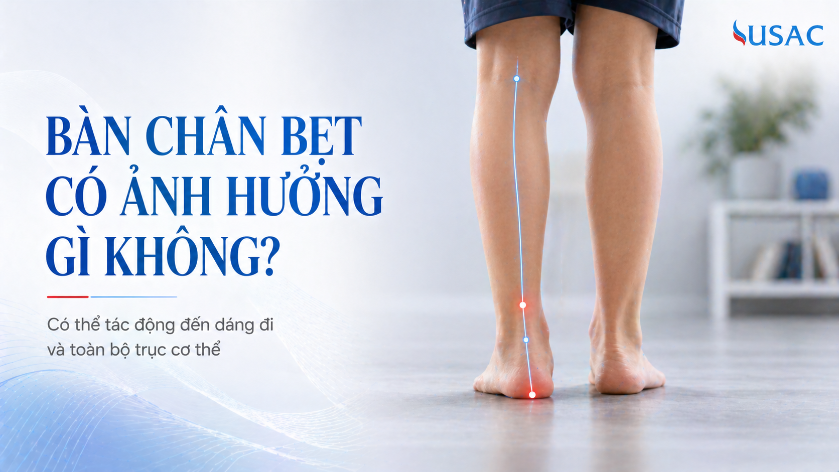 Bàn chân bẹt có ảnh hưởng gì không