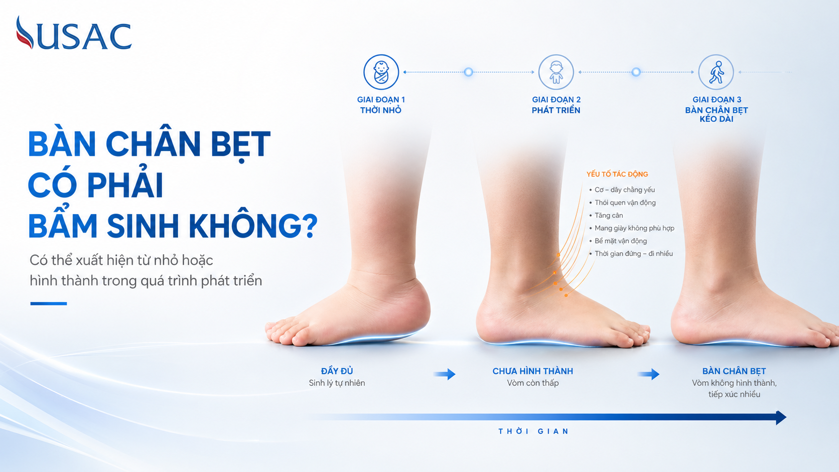 Bàn Chân Bẹt Có Phải Bẩm Sinh Không