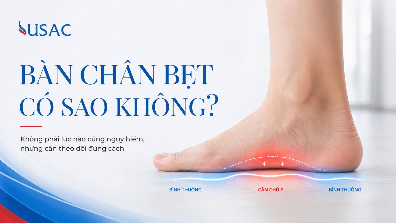 Bàn Chân Bẹt Có Sao Không