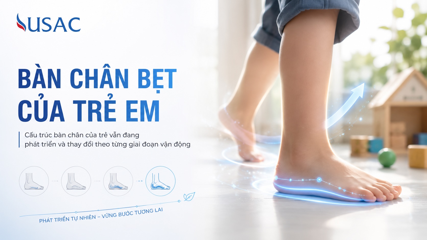 Bàn Chân Bẹt Của Trẻ Em Bàn Chân Bẹt Của Trẻ Em