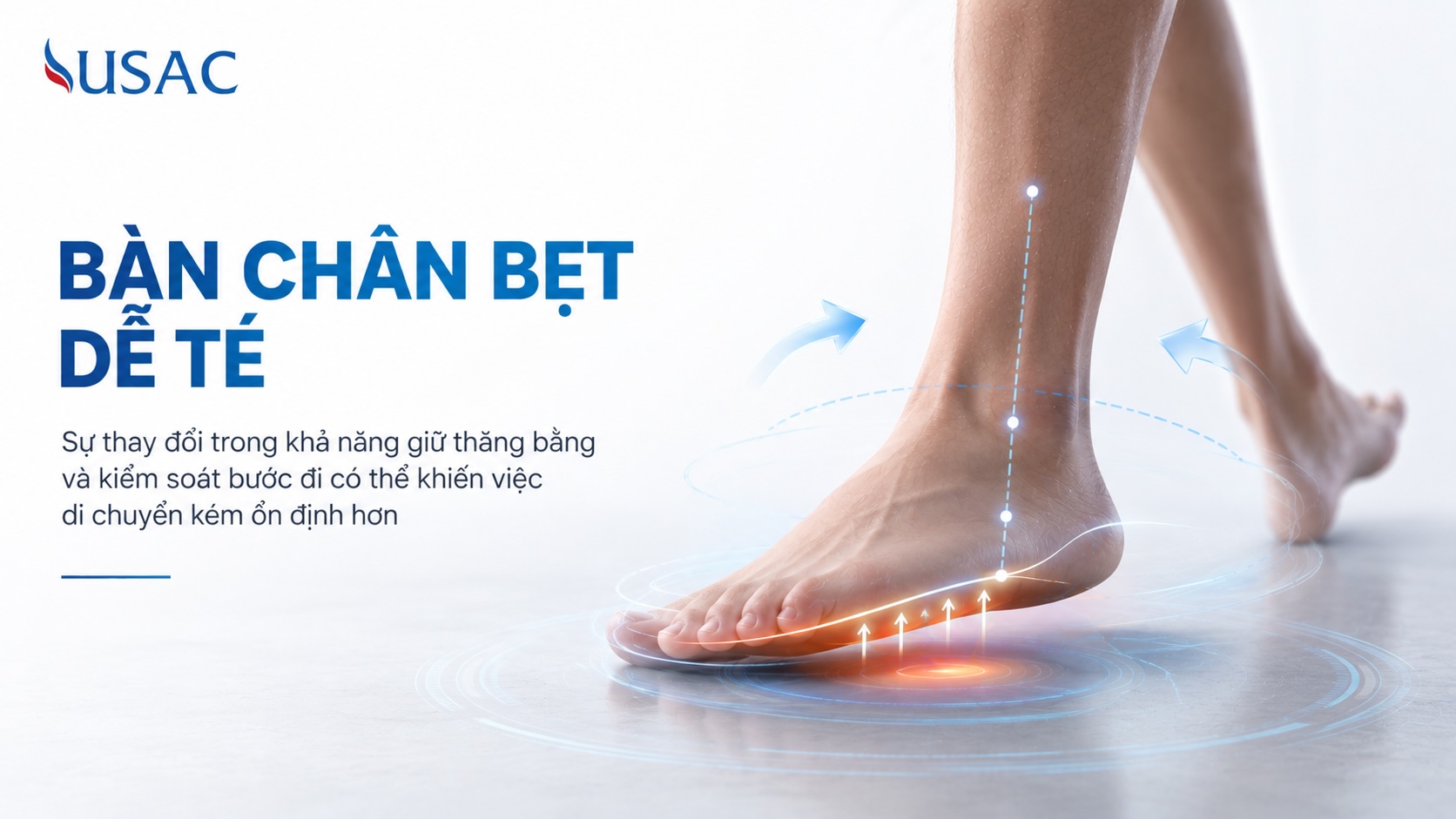 Bàn Chân Bẹt Dễ Té Bàn Chân Bẹt Dễ Té