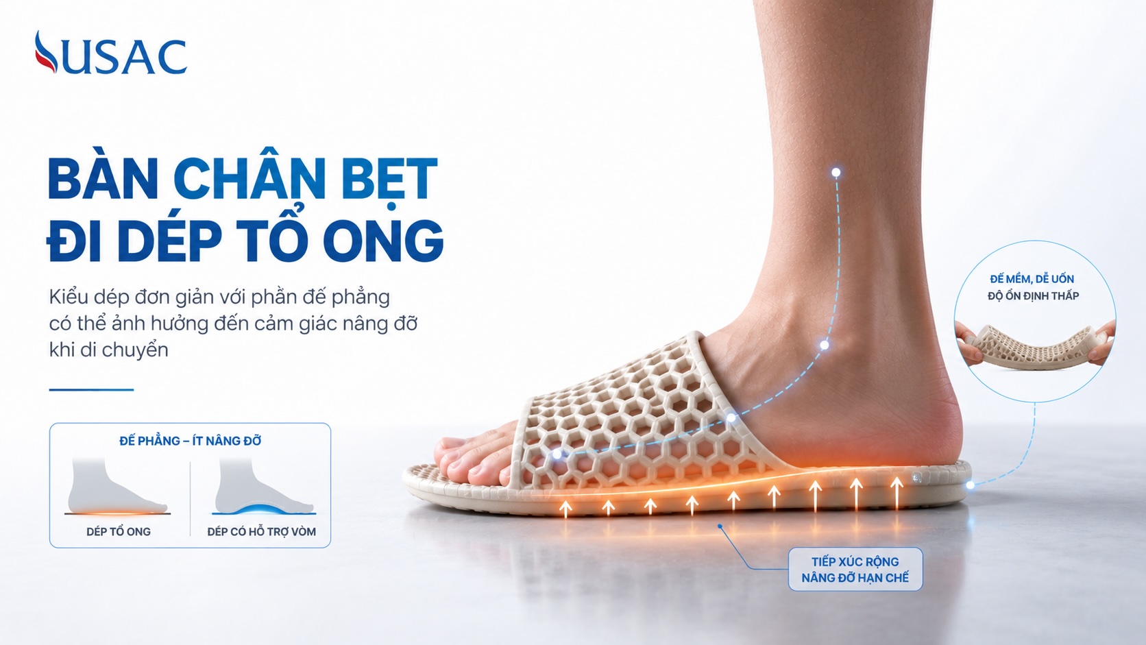 Bàn Chân Bẹt Đi Dép Tổ Ong Bàn Chân Bẹt Đi Dép Tổ Ong