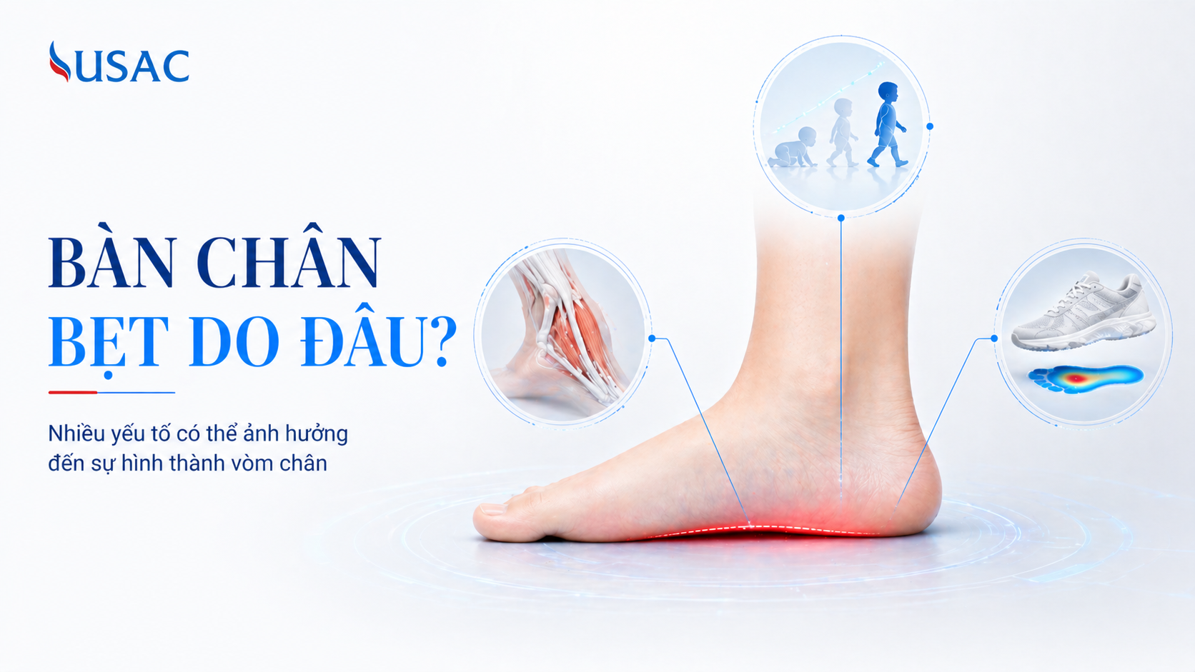 Bàn Chân Bẹt Do Đâu