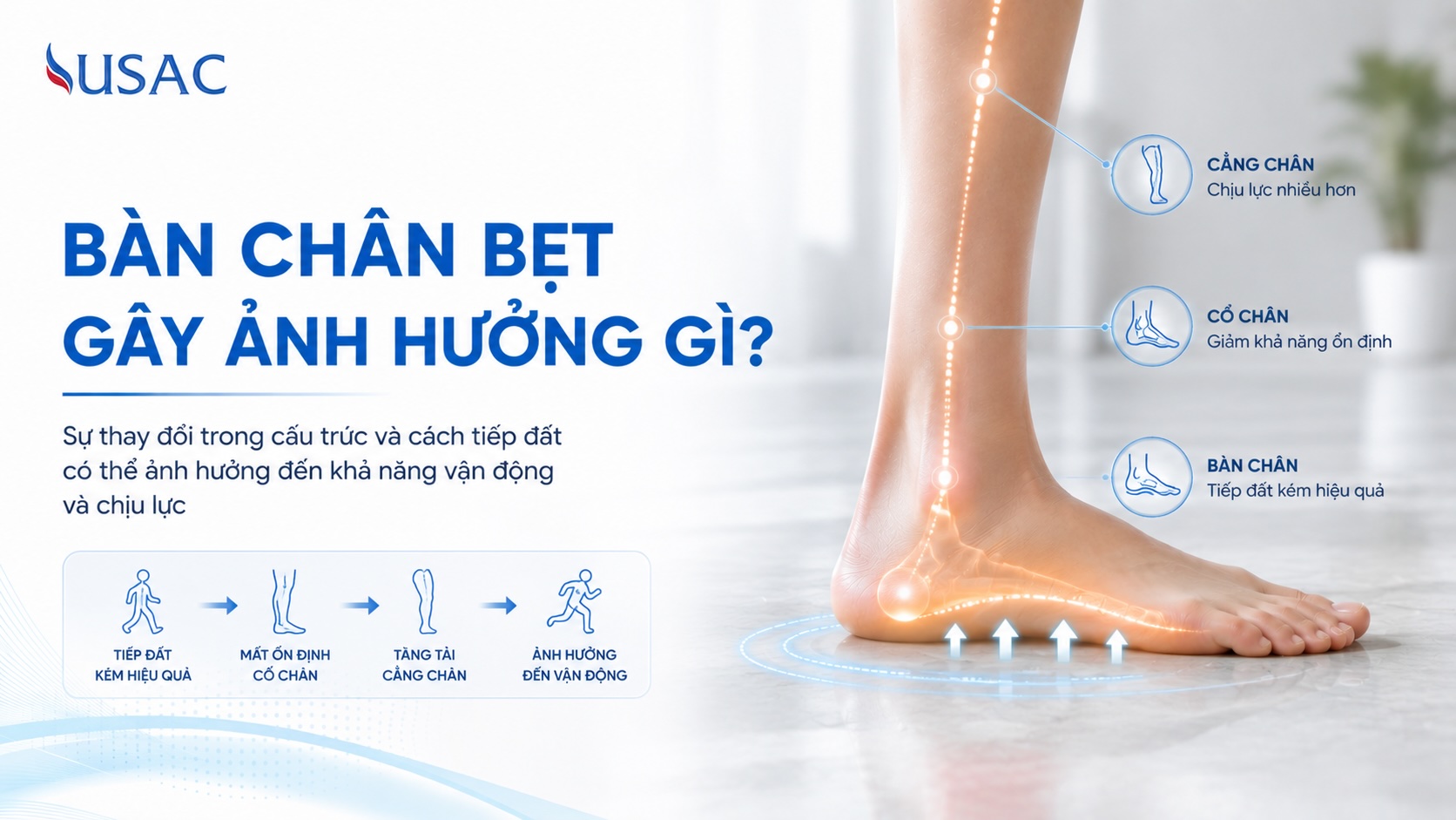 Bàn Chân Bẹt Gây Ảnh Hưởng Gì