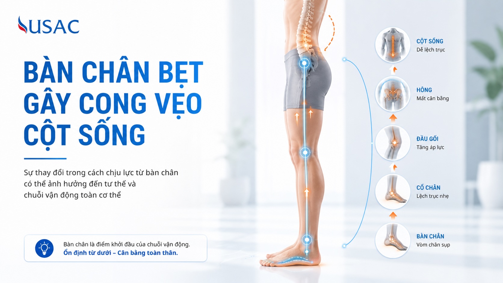 Bàn Chân Bẹt Gây Cong Vẹo Cột Sống Bàn Chân Bẹt Gây Cong Vẹo Cột Sống