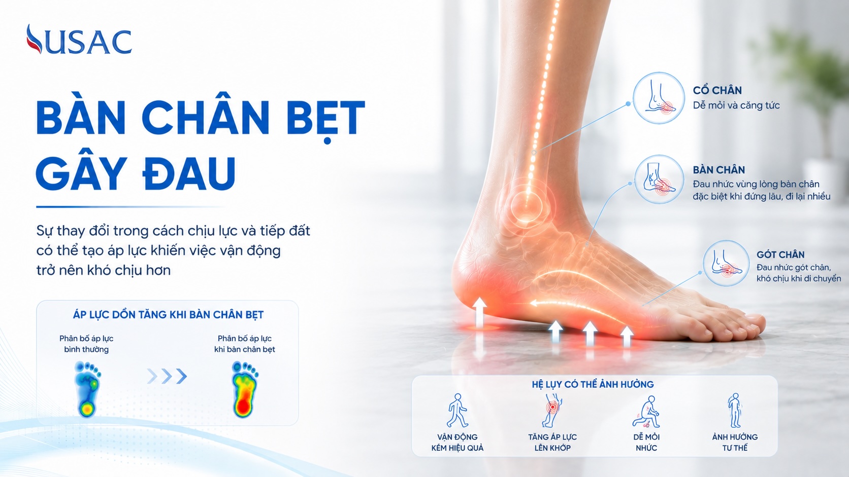 Bàn Chân Bẹt Gây Đau