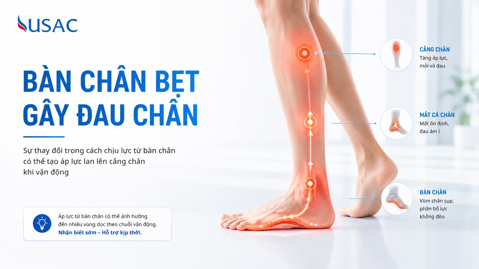 Bàn Chân Bẹt Gây Đau Chân Bàn Chân Bẹt Gây Đau Chân
