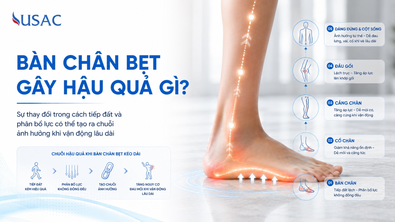 Bàn Chân Bẹt Gây Hậu Quả Gì Bàn Chân Bẹt Gây Hậu Quả Gì
