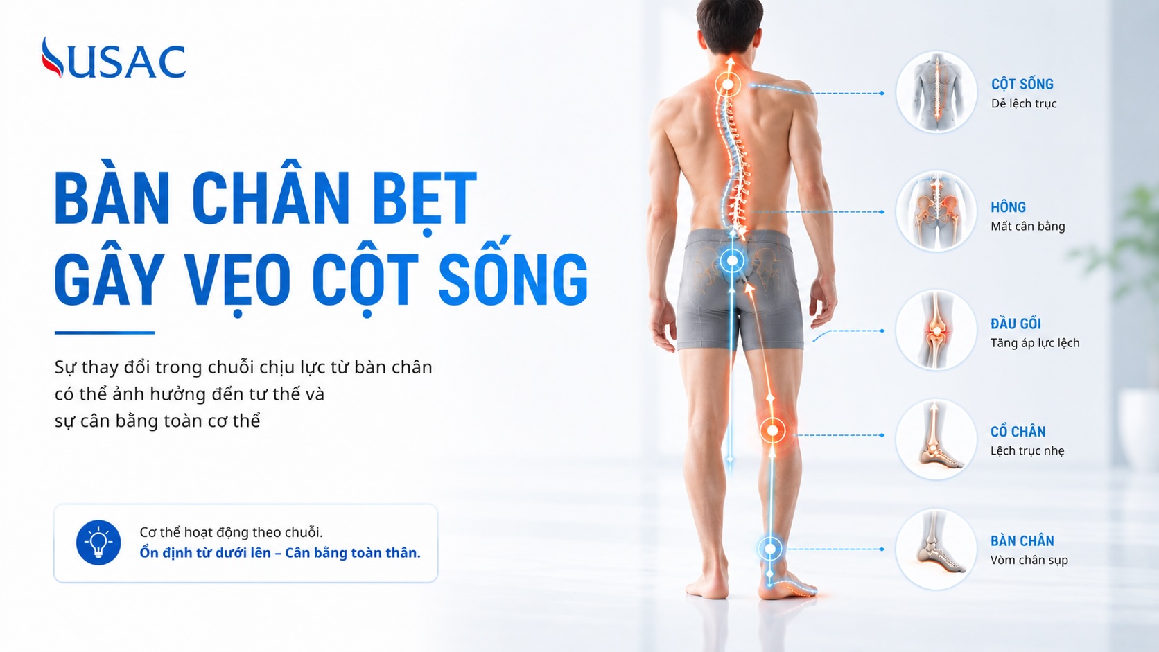 Bàn Chân Bẹt Gây Vẹo Cột Sống Bàn Chân Bẹt Gây Vẹo Cột Sống