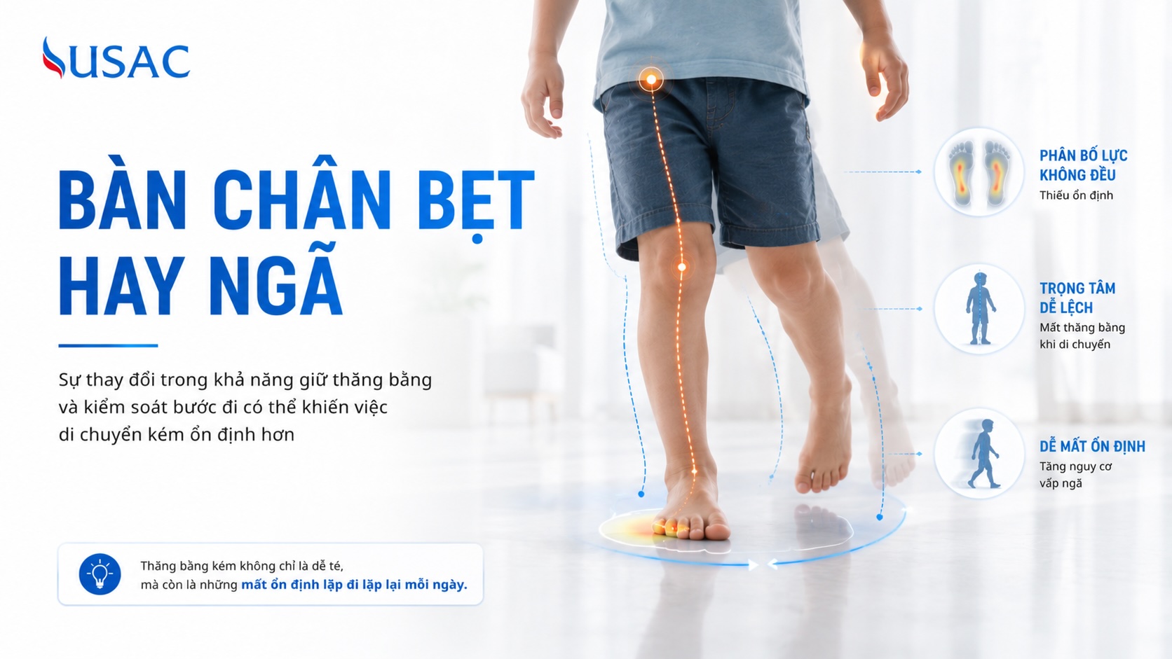 Bàn Chân Bẹt Hay Ngã
