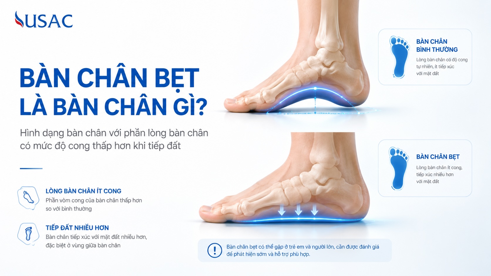 Bàn Chân Bẹt Là Bàn Chân Gì Bàn Chân Bẹt Là Bàn Chân Gì